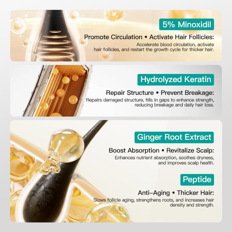 Viral KORMESIC 5% Minoxidil Hair Growth