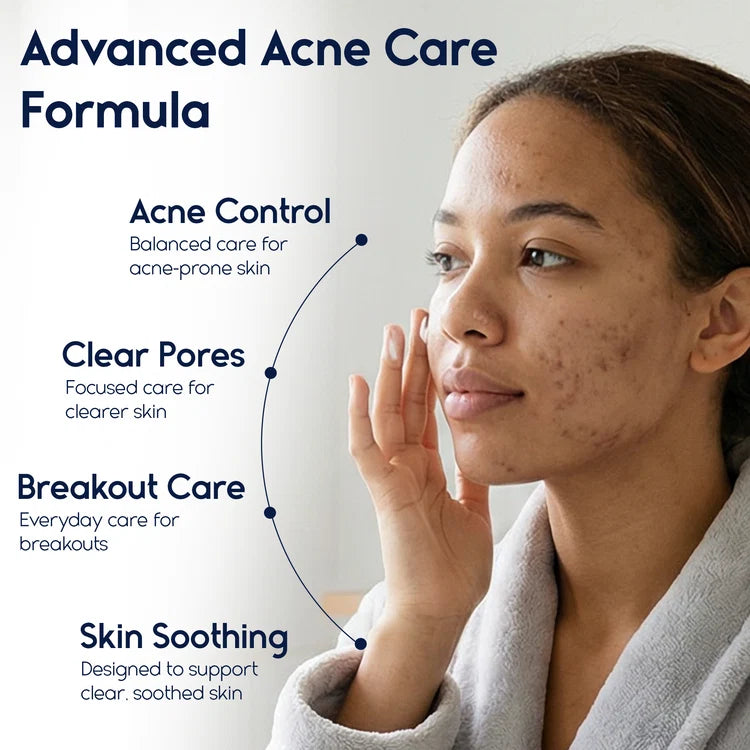 Azelaic Acid 15% Cream – Acne Control, Redness Relief & Tone Correction | 30ml