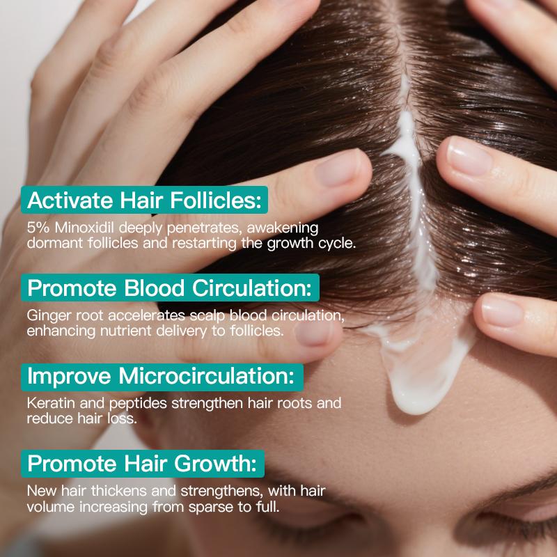 Viral KORMESIC 5% Minoxidil Hair Growth