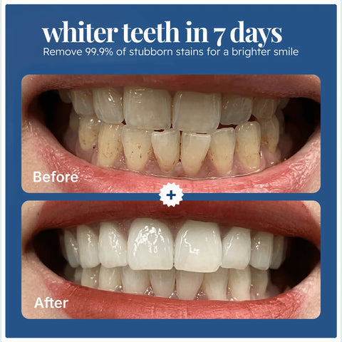 Viral EcoBrightSmile® Triple Action Teeth Whitening Powder