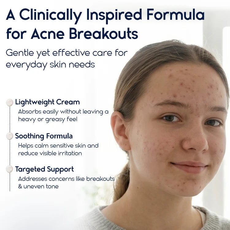 Azelaic Acid 15% Cream – Acne Control, Redness Relief & Tone Correction | 30ml